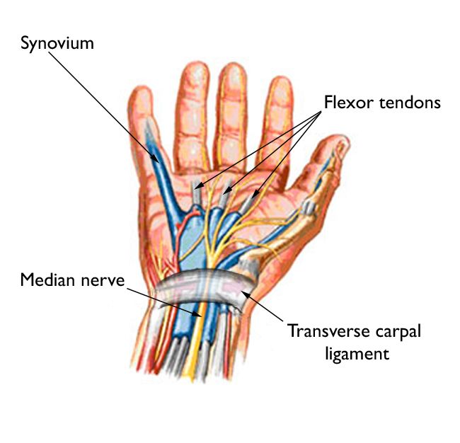 carpal tunnel