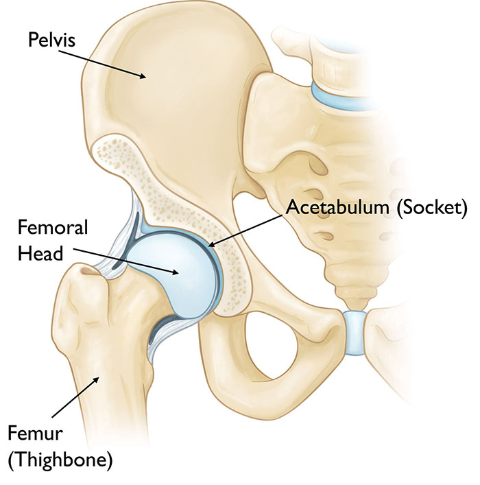 hip fracture