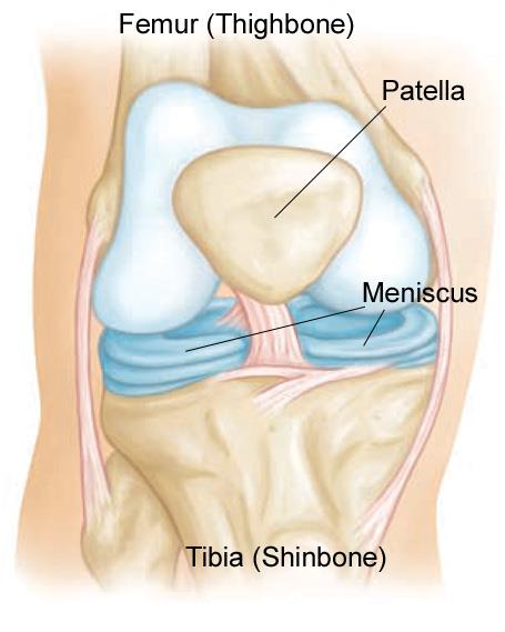 meniscus tears